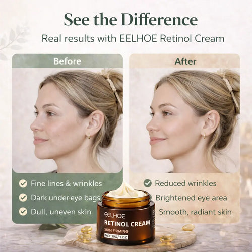 EELHOE Retinol Cream